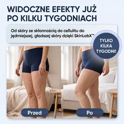 SkinLabX™ Reduktor Cellulitu